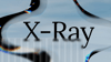 Announcing Stellar X-Ray, Protocol 25
